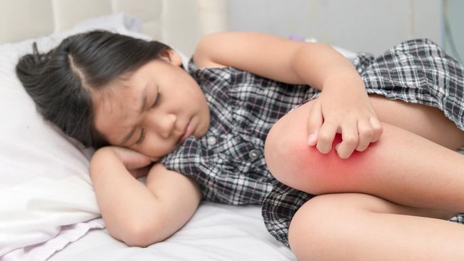 4 Penyebab Si Kecil Gelisah saat Tidur, Salah Satunya Banyak Nyamuk